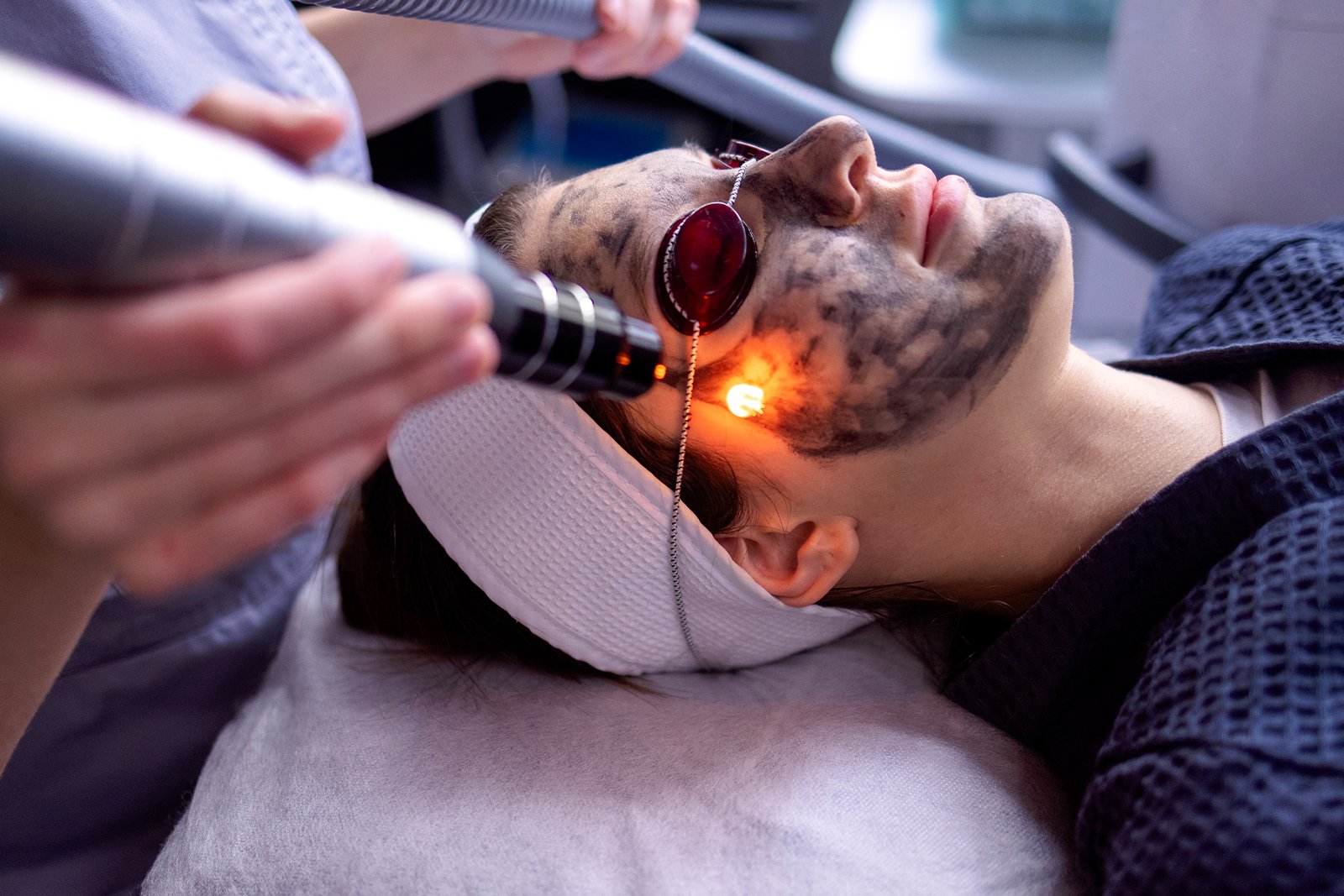 Carbon-toning-Carbon-facial