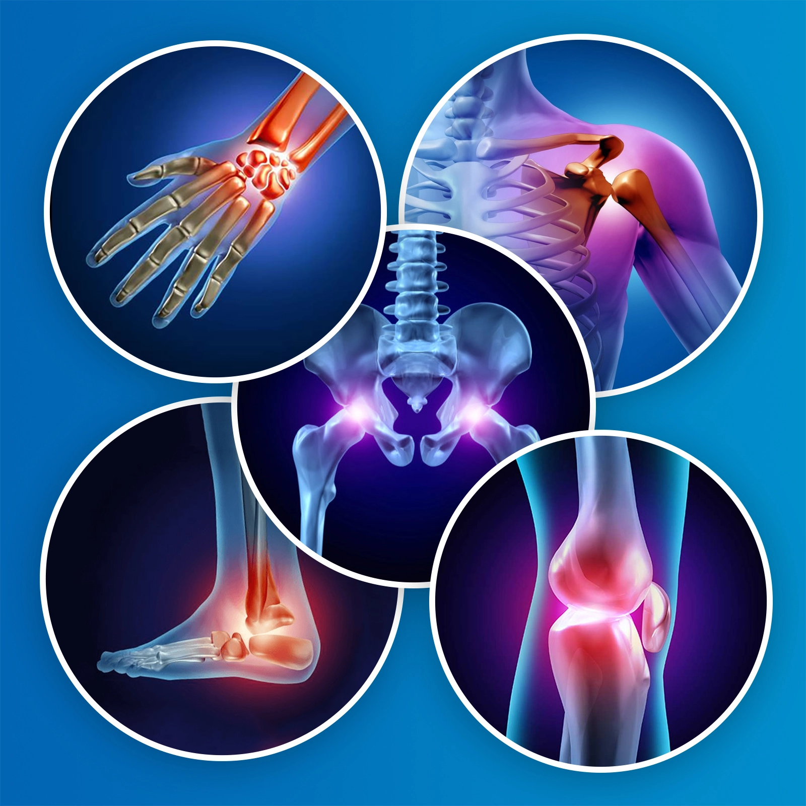 Orthopedic
