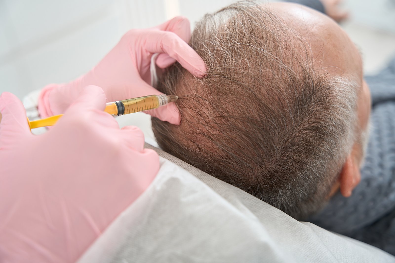 prp-gf-mesotherapy-for-hair-growth-&-skin-rejuvenation
